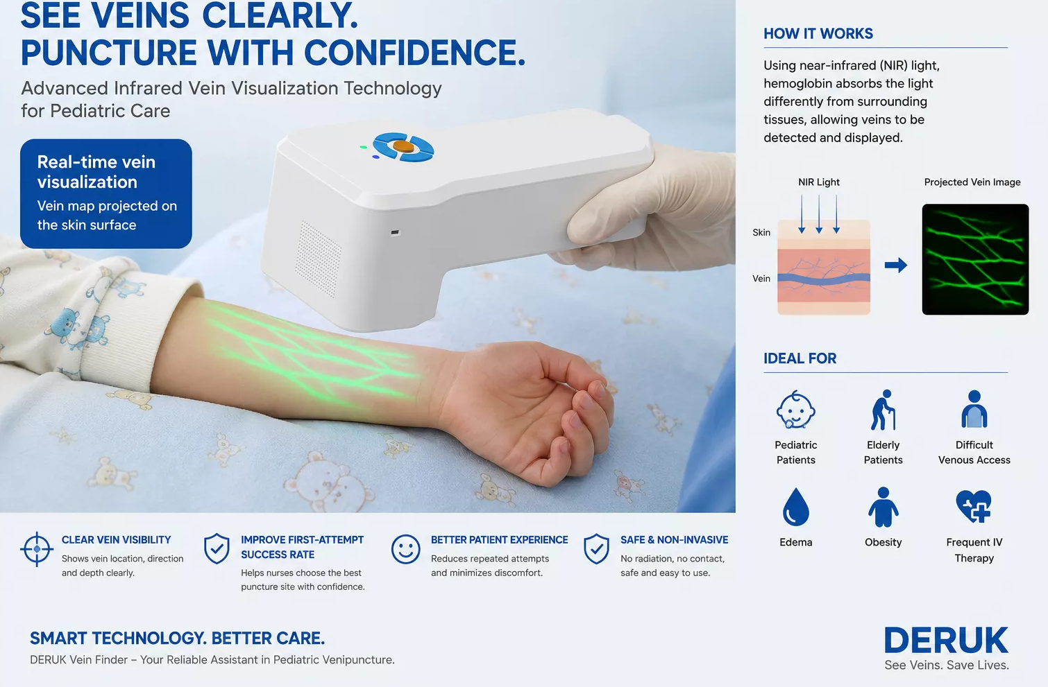 Fukang People's Hospital Uses Vascular Imaging Device to "Navigate" Pediatric Venipuncture