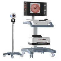 Colposcope