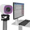 Colposcope