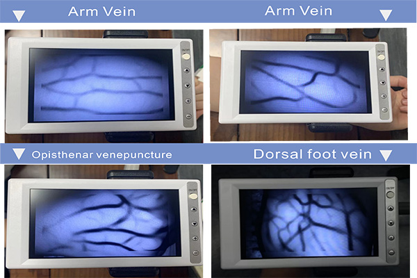 <h1><span style="color:#27ae60;"><span style="font-size:20px;"><strong>Multi-Part Vein Imaging Display</strong></span></span></h1> 