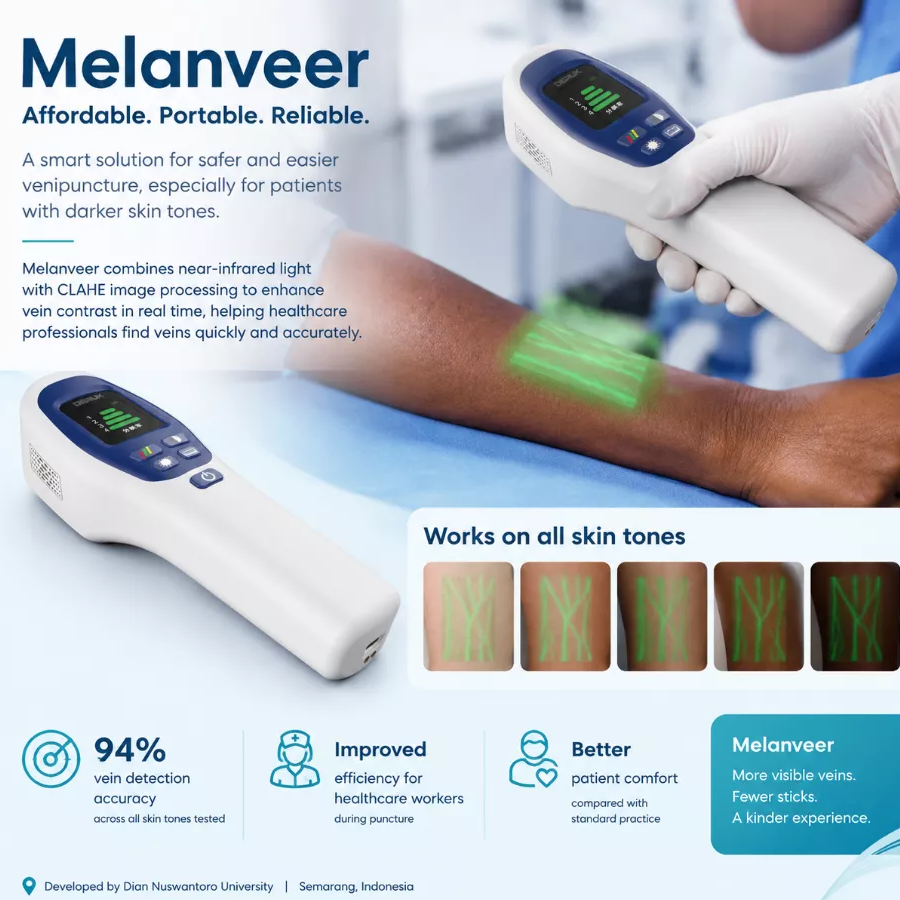 What A Caribbean Trial Revealed About Vein Finders for Dark-Skinned Children