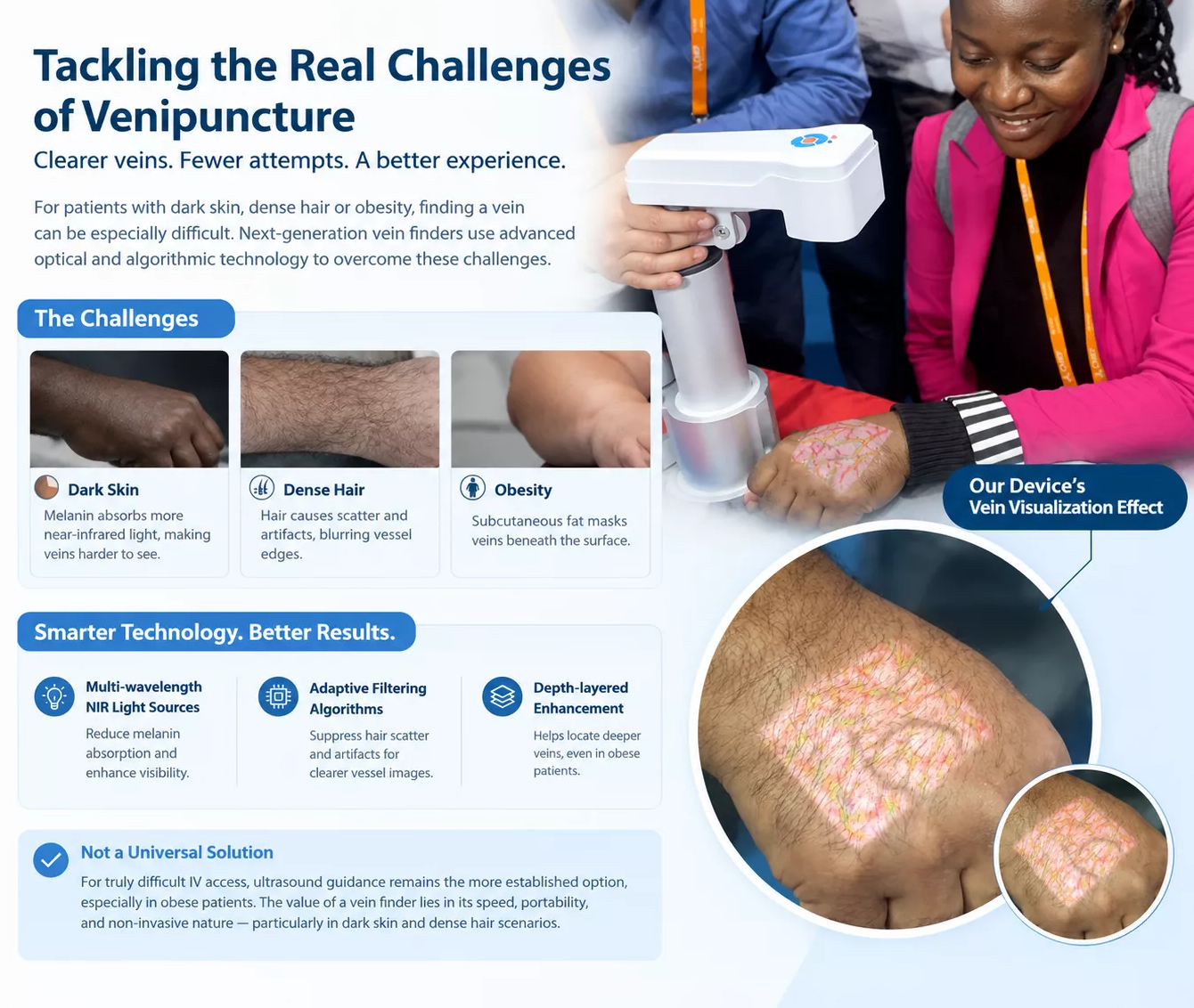 Breaking Through Dark Skin and Dense Hair Barriers: How Next-Generation Vein Finders Improve Venipuncture