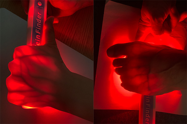 <span style="font-size:12px;"><strong>Vein Visualization Comparison: Hand &amp; Foot Veins Clear Display</strong></span>