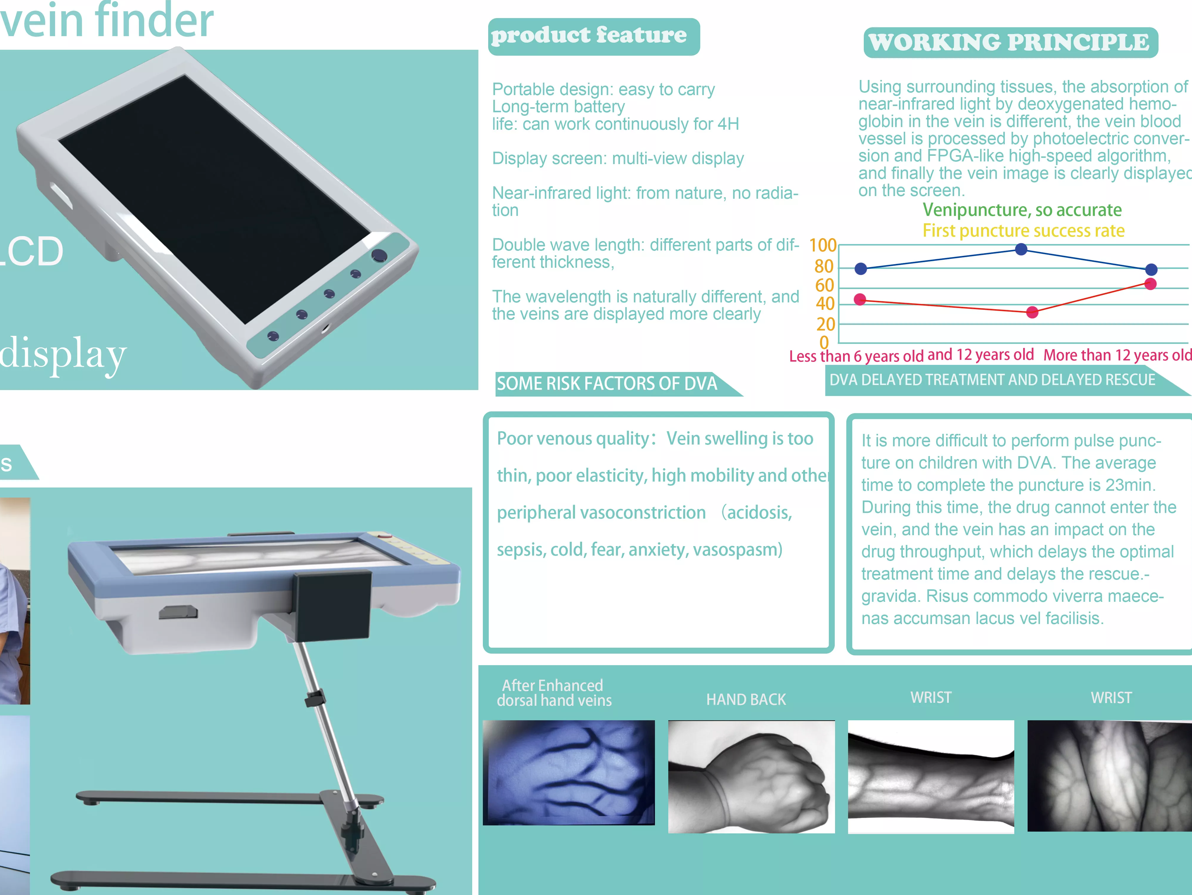 Vein Visualization Technology in Breast Cancer Surgery | Improving Surgical Precision and Safety