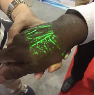How a Low-Cost Vein Finder Achieved 94% Accuracy Across All Skin Tones in Indonesia